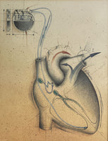 Anatomical Heart Pacemaker Retro Medical Poster F. Gendre Illustrator 80s 90s